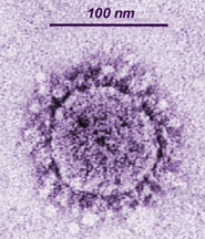 SARS virus